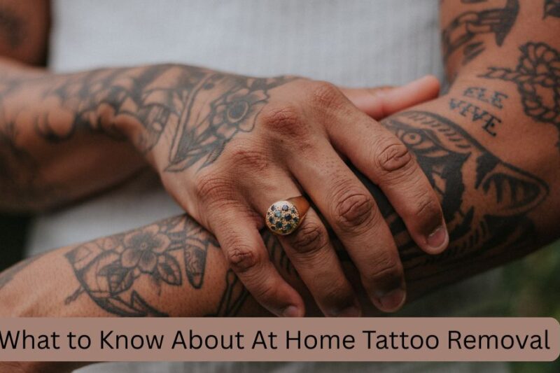 What to Know About At Home Tattoo Removal