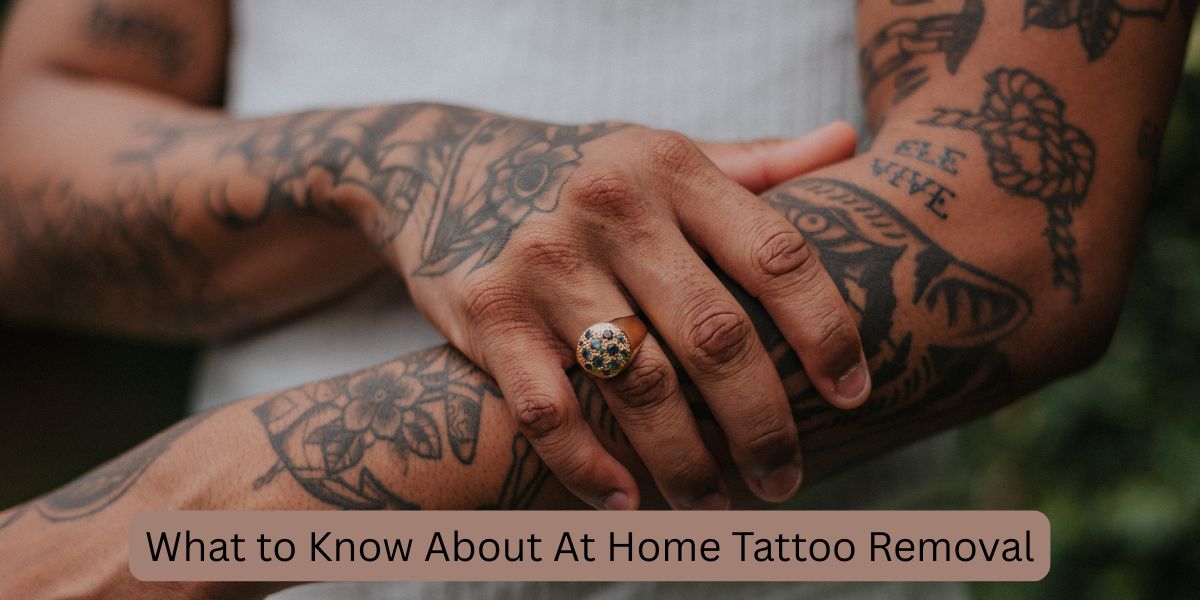 What to Know About At Home Tattoo Removal